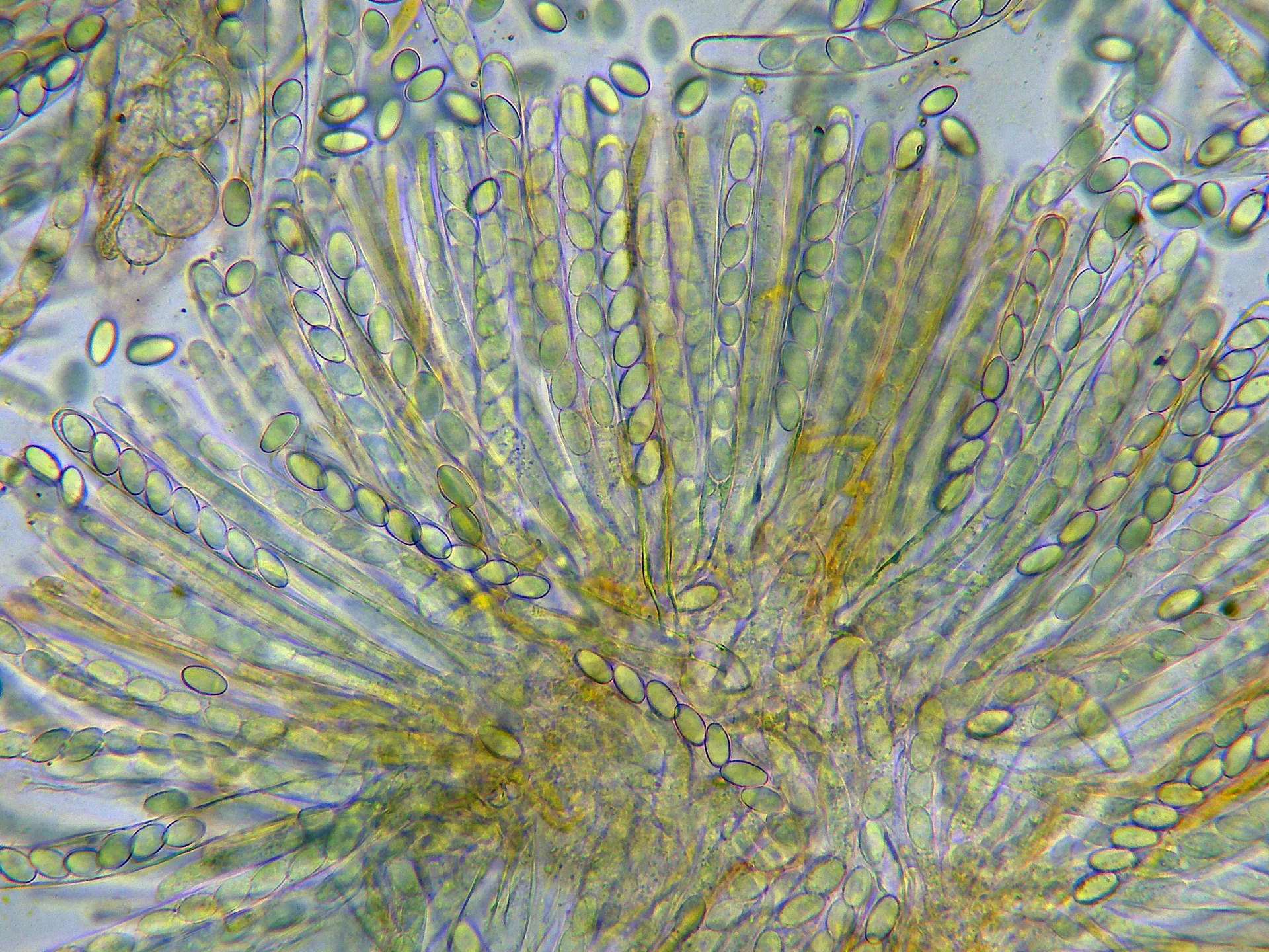 Microscopía de Pyronema omphalodes - 10 - Himenio x 400-001